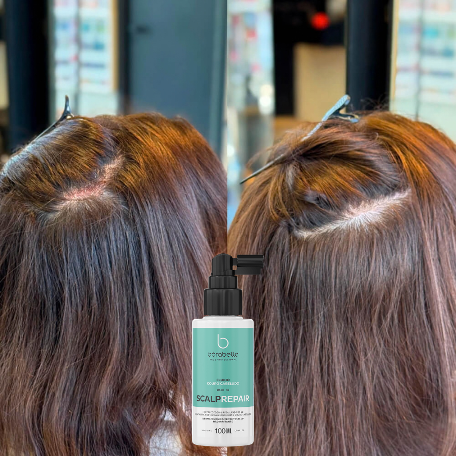 Borabella Scalp Repair 100ml – Fluido Fortalecedor para Couro Cabeludo